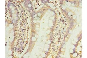 Immunohistochemistry of paraffin-embedded human small intestine tissue using ABIN7165992 at dilution of 1:100 (PRRC1 Antikörper  (AA 200-445))