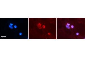 Rabbit Anti-NR1I2 Antibody    Formalin Fixed Paraffin Embedded Tissue: Human Adult heart  Observed Staining: Nuclei in adipocytes but not in cardiomyocytes Primary Antibody Concentration: 1:100 Secondary Antibody: Donkey anti-Rabbit-Cy2/3 Secondary Antibody Concentration: 1:200 Magnification: 20X Exposure Time: 0. (NR1I2 Antikörper  (N-Term))
