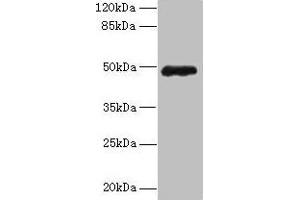 Western blot All lanes: ZNF562 antibody at 12 μg/mL + 293T whole cell lysate Secondary Goat polyclonal to rabbit IgG at 1/10000 dilution Predicted band size: 49, 41 kDa Observed band size: 49 kDa (ZNF562 Antikörper  (AA 201-426))