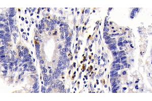 Immunohistochemistry (IHC) image for anti-Interleukin 7 Receptor (IL7R) (AA 173-260) antibody (ABIN7434320)