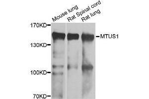 Western blot analysis of extracts of various cell lines, using MTUS1 antibody. (MTUS1 Antikörper)