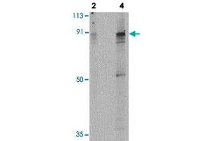 Western blot analysis of PAK7 in T24 lysate with PAK7 polyclonal antibody  at 2 and 4 ug/mL .