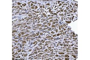 IHC analysis of ERLIN2 using anti-ERLIN2 antibody (ABIN7602582).