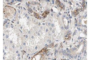 ABIN6279570 at 1/100 staining Human kidney tissue by IHC-P. (NNT Antikörper  (C-Term))