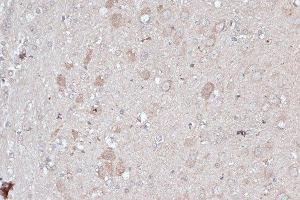 Immunohistochemistry of paraffin-embedded rat brain using MAP1LC3B antibody. (LC3B Antikörper)