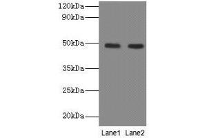 Western blot All lanes: NEU3 antibody at 2 μg/mL Lane 1: A549 whole cell lysate Lane 2: U251 whole cell lysate Secondary Goat polyclonal to rabbit IgG at 1/10000 dilution Predicted band size: 49, 52 kDa Observed band size: 49 kDa (Neu3 Antikörper  (AA 2-428))