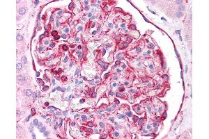 Vimentin antibody was used for immunohistochemistry at a concentration of 4-8 ug/ml. (Vimentin Antikörper  (C-Term))