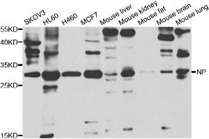 Western blot analysis of extracts of various cell lines, using PNP antibody. (NP Antikörper)