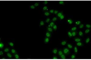 Immunofluorescence analysis of MCF7 cells using SOX5 Polyclonal Antibody (SOX5 Antikörper)