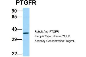 Host: Rabbit Target Name: PTGFR Sample Type: Human 721_B Antibody Dilution: 1.