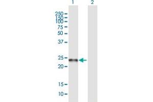 Western Blot analysis of C19orf50 expression in transfected 293T cell line ( H00079036-T01 ) by C19orf50 MaxPab polyclonal antibody. (C19orf50 Antikörper  (AA 1-176))