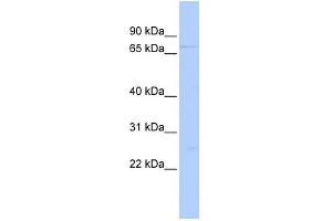 WB Suggested Anti-DDX59 Antibody Titration:  0. (DDX59 Antikörper  (Middle Region))