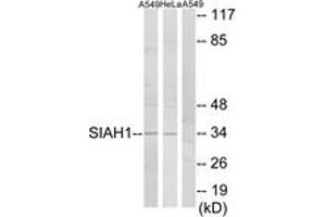 Western blot analysis of extracts from A549/HeLa cells, using SIAH1 Antibody.