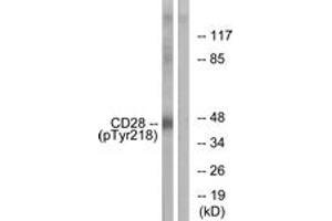 Western blot analysis of extracts from HepG2 cells treated with nocodazole 1ug/ml 16h, using CD28 (Phospho-Tyr218) Antibody. (CD28 Antikörper  (pTyr218))