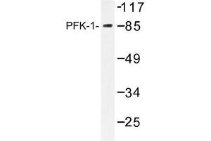 Image no. 2 for anti-Phosphofructokinase, Liver (PFKL) antibody (ABIN272176) (PFKL Antikörper)