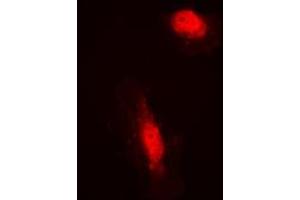 Immunofluorescent analysis of COPS3 staining in HeLa cells. (COPS3 Antikörper  (Center))