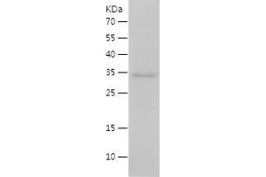 Western Blotting (WB) image for Interleukin 15 (IL15) (AA 49-162) protein (His-IF2DI Tag) (ABIN7123550) (IL-15 Protein (AA 49-162) (His-IF2DI Tag))
