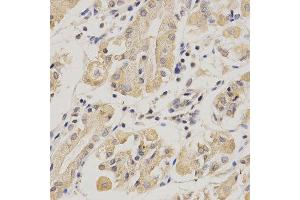Immunohistochemistry of paraffin-embedded human stomach using SERPINF1 antibody at dilution of 1:200 (x400 lens). (PEDF Antikörper)