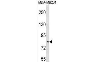 LRRC70 Antibody (C-term) (ABIN1537455 and ABIN2850345) western blot analysis in MDA-M cell line lysates (35 μg/lane). (LRRC70 Antikörper  (C-Term))