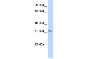 WB Suggested Anti-RHOXF2 Antibody Titration:  0. (RHOXF2 Antikörper  (Middle Region))