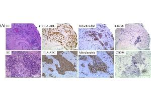 HLA-ABC identifies cells of human origin in xenografted mice. (ATPase Beta3 (Center) Antikörper)