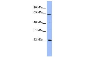 WB Suggested Anti-FREQ Antibody Titration:  0. (NCS1 Antikörper  (Middle Region))