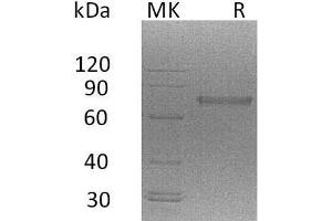 Natural Cytotoxicity Triggering Receptor 1 (NCR1) protein (His tag)