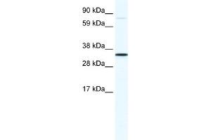 WB Suggested Anti-MSX1 Antibody Titration:  1. (MSX1 Antikörper  (N-Term))