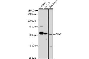Western blot analysis of extracts of various cell lines, using CRY2 antibody (ABIN6130207, ABIN6139069, ABIN6139071 and ABIN6222617) at 1:1000 dilution. (CRY2 Antikörper  (AA 455-614))
