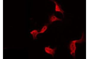 ABIN6275338 staining Hela by IF/ICC. (PDRG1 Antikörper  (Internal Region))
