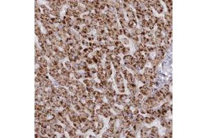 Immunohistochemical staining (Formalin-fixed paraffin-embedded sections) of human liver with ARSB polyclonal antibody  shows strong cytoplasmic positivity in hepatocytes. (Arylsulfatase B Antikörper)