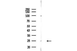 anti-Progesterone Receptor Membrane Component 1 (PGRMC1) (C-Term) antibody