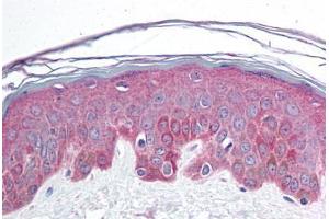 Human Skin (formalin-fixed, paraffin-embedded) stained with BRD7 antibody ABIN214730 at 10 ug/ml followed by biotinylated goat anti-rabbit IgG secondary antibody ABIN481713, alkaline phosphatase-streptavidin and chromogen. (BRD7 Antikörper  (C-Term))