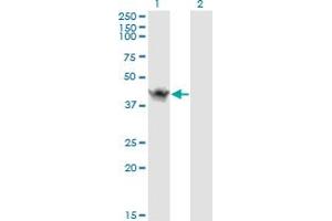 Western Blot analysis of ASB9 expression in transfected 293T cell line by ASB9 monoclonal antibody (M01), clone 1D8.
