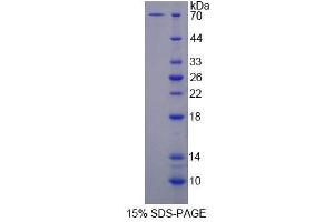 SDS-PAGE analysis of Rat SURF1 Protein. (SURF1 Protein)