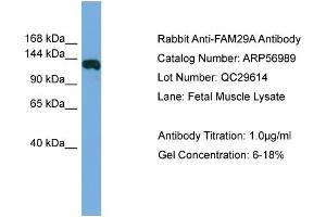 WB Suggested Anti-FAM29A  Antibody Titration: 0. (FAM29A Antikörper  (Middle Region))