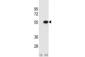 Western blot analysis of Reptin antibody and 293 cell lysate (2 ug/lane) either nontransfected (Lane 1) or transiently transfected (2) with the RUVBL2 gene. (RUVBL2 Antikörper  (AA 400-430))
