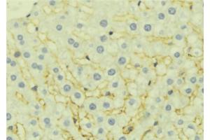 ABIN6277061 at 1/100 staining Mouse liver tissue by IHC-P. (EPHX1 Antikörper  (Internal Region))