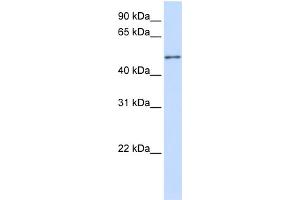WB Suggested Anti-ZNF561 Antibody Titration:  0. (ZNF561 Antikörper  (C-Term))
