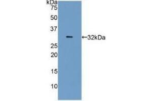 Detection of Recombinant CA4, Human using Polyclonal Antibody to Carbonic Anhydrase IV (CA4) (CA4 Antikörper  (AA 19-283))