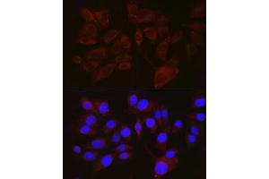 Immunofluorescence analysis of  cells using PMEL Rabbit pAb (ABIN7269510) at dilution of 1:100 (40x lens). (Melanoma gp100 Antikörper  (AA 25-300))