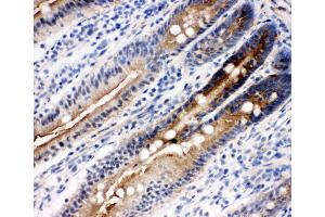 Anti-DDX4/MVH antibody, IHC(F) IHC(F): Rat Intestine Tissue