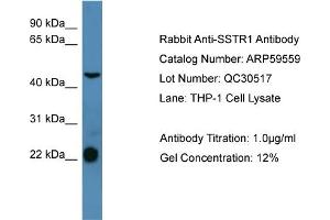 WB Suggested Anti-SSTR1  Antibody Titration: 0. (SSTR1 Antikörper  (C-Term))