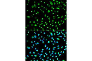 Immunofluorescence analysis of HeLa cell using WT1 antibody. (WT1 Antikörper  (AA 1-302))