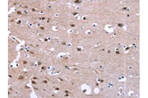 The image on the left is immunohistochemistry of paraffin-embedded Human brain tissue using ABIN7190847(GPR171 Antibody) at dilution 1/25, on the right is treated with synthetic peptide. (GPR171 Antikörper)