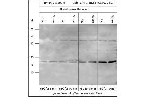 Western blot on brain lysates using Rabbit antibody to pro BDNF (50-90): .