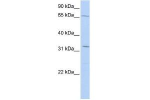 TRIM22 antibody used at 0. (TRIM22 Antikörper  (Middle Region))