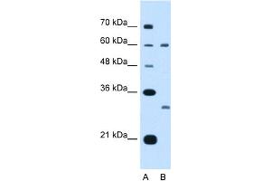 WB Suggested Anti-TSPAN32 Antibody Titration:  5.