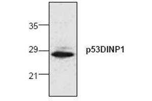 Image no. 1 for anti-Tumor Protein P53 Inducible Nuclear Protein 1 (TP53INP1) (N-Term) antibody (ABIN155075) (TP53INP1 Antikörper  (N-Term))