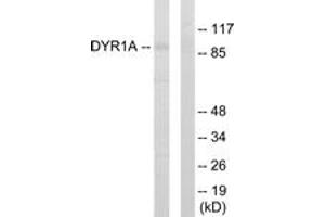 Western blot analysis of extracts from HepG2 cells, using DYR1A Antibody. (DYRK1A Antikörper  (AA 21-70))